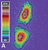 Comparison of segmentation algorithms for fluorescence microscopy images of cells 