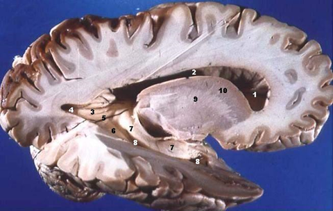 dissected human brain