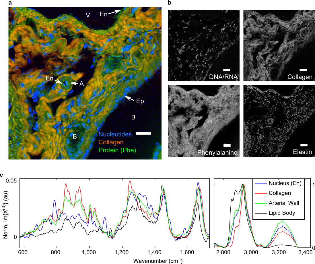 BCARS image of murine liver tissue with various hepatic structures identified.