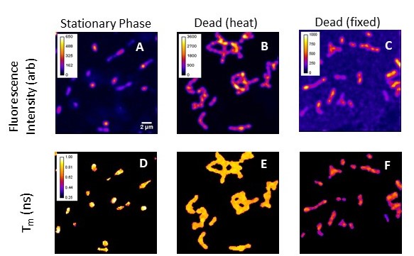 Fluorescence lifetime microscopy (FLIM) of microbes