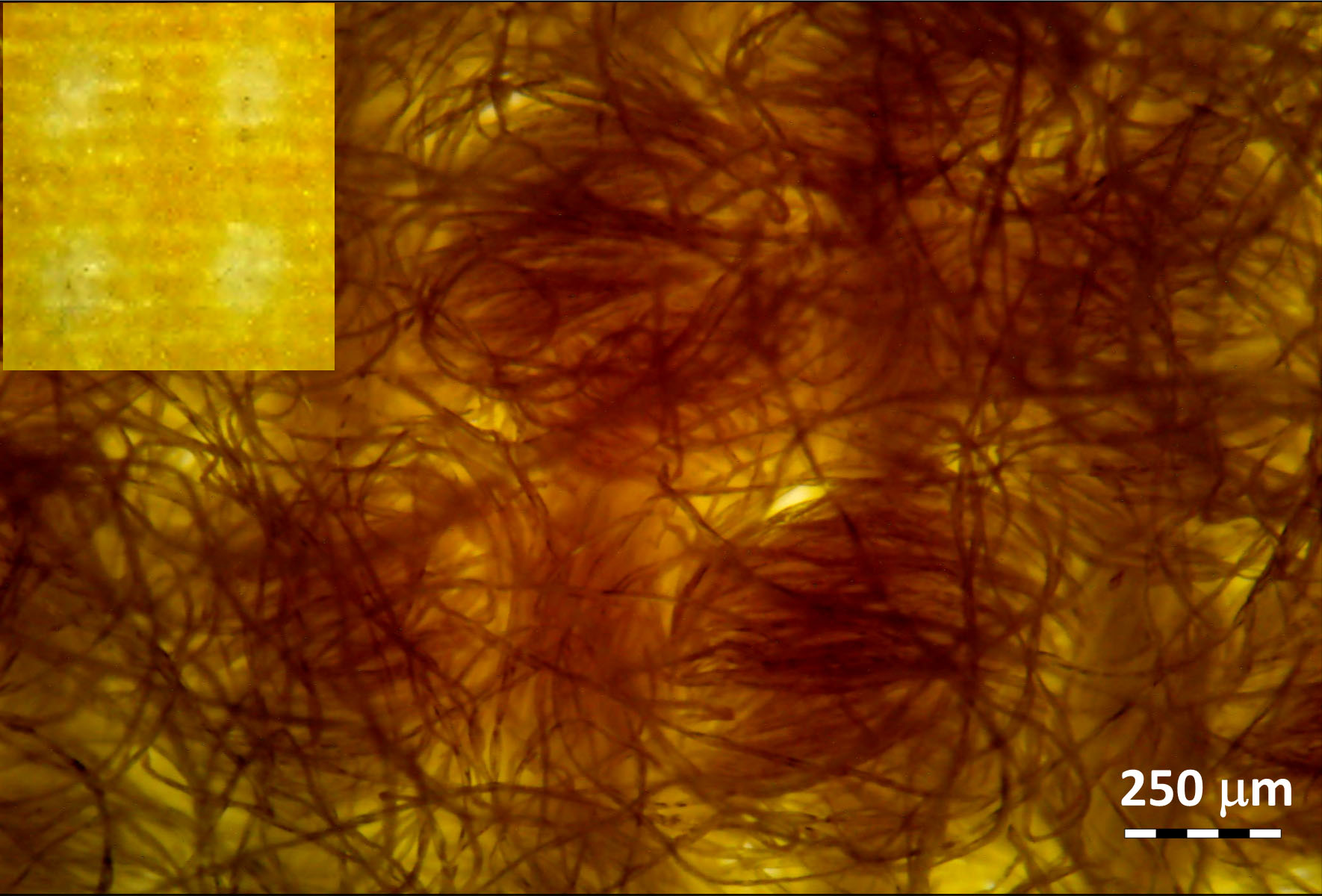 Micrograph shows coiled fibers on yellow background with inset of lighter yellow square. 