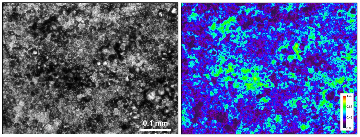 Image:  Left - Bright-field image of tissue-engineered RPE cells. Right – The corresponding quantitative bright-field absorbance microscopy image.