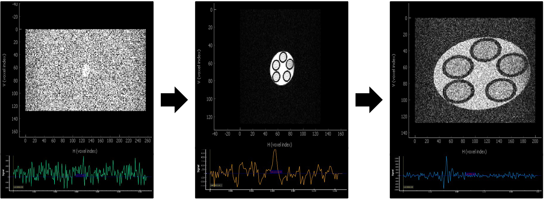 a series of MRI images that shows a progression of clarity from left to right. In the leftmost picture there is static and a round object at the center is barely seen. In the middle the static is gone and the object is small and distorted but clear, the final panel shows the image completely clear with a pentagonal group of circles inside the larger circle.