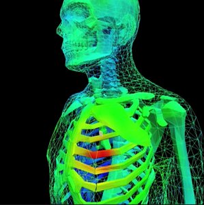 VideoStill: An Immersive Visualization Environment to Study RF Propagation from Medical Implants