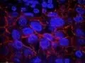 Breast Cancer Cells