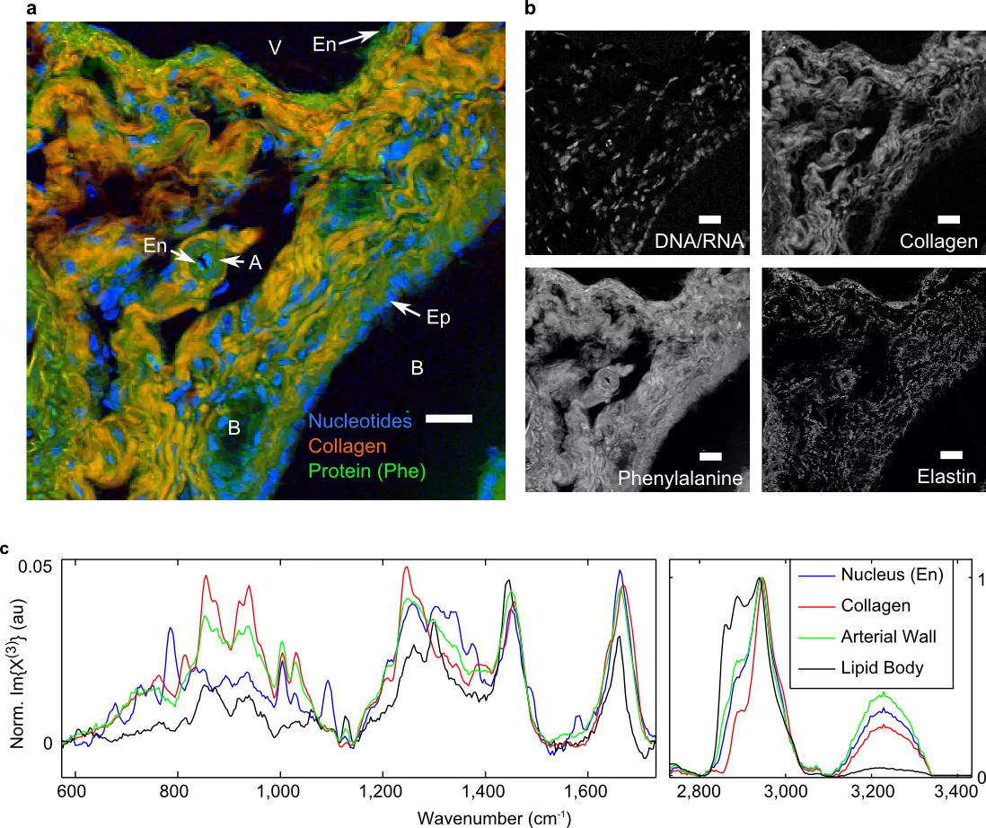 BCARS image of murine liver tissue with various hepatic structures identified.