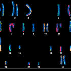 An image showing 22 pairs of numbered and color-coded chromosomes on a black background.