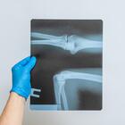 A person wearing a blue medical glove holds up an X-ray film of a bone joint. 