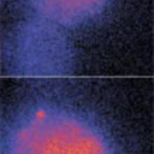 Fluorescent images of two liposomes fusing