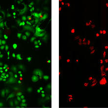 Photomicrographs demonstrate the dramatic impact of using nanotubes to selectively locate and destroy HER2 breast cancer tumors. 