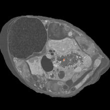 Cross section of the roundworm C. elegans