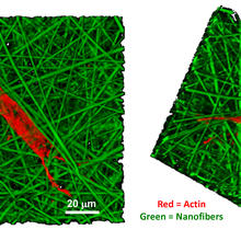 confocal microscope images detail the growth of a human bone marrow stromal cell on a nanofiber scaffold.