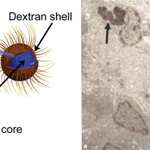 An illustration of an iron-centered nanoparticle and a micrograph of a tumor cell ingesting the nanoparticle