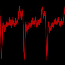 Colorized trace of pulses from the NIST/JILA "dark pulse" laser