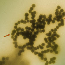 Transmission electron micrograph of gold nanoparticles clustering in solution.