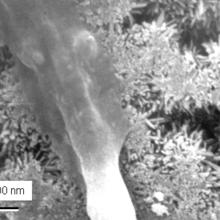 High-magnification scanning electron micrograph of the leg of an osteoblast