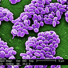 This scanning electron micrograph shows spores from the anthrax vaccine strain of Bacillus anthracis.