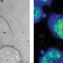 Test cells from a mouse as seen in an optical microscope image (l.), and using B-CARS (r.). 