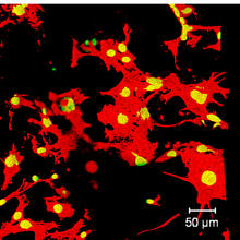 Confocal microscope images show how growth and adhesion of bone cells differ across a subset of 3-D scaffolds made with systematically varying blends of ingredients. 
