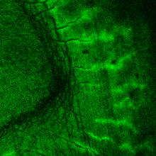 Deposits of hydroxyapatite crystal light up bright green where they've been tagged with a new peptide