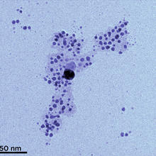Transmission electron microscopy (TEM) image of silver nanoparticles