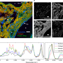 BCARS image of murine liver tissue with various hepatic structures identified.