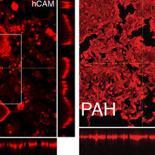 Box on left of red images on black background with hCAM, and on right with red images on black backgrounds with PAH