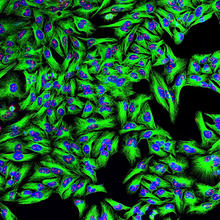 In this image, we see green wherever monoclonal antibodies have attached to cancer cells.
