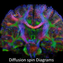 Brain wiring diagram