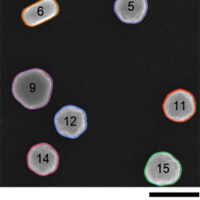 Gold nanoparticles