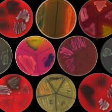 Microbial Strain