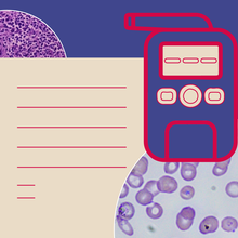 Illustration shows a breathalyzer device with a paper report and microscope slides. 