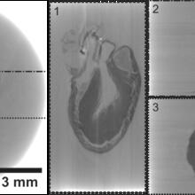 Images of mouse heart