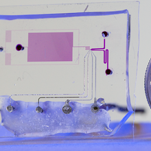 microfluidic channel system