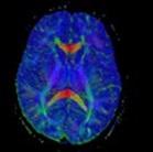 MedicalImaging2014 MedicalImaging2014