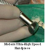 Modern Ultra-High Speed Handpiece
