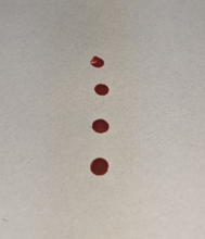 Photo of blood droplets