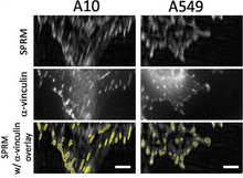 Mass Measurements of Focal Adhesions in Single Cells 