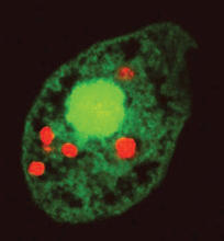 Nanoparticles in a cell