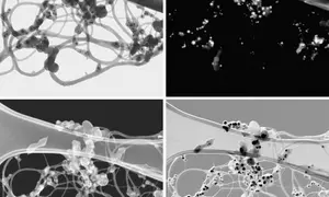 t-SEM images of single wall carbon nanotube bundles with metal catalyst particles. Image width = 1 μm.