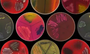 Microbial Strain