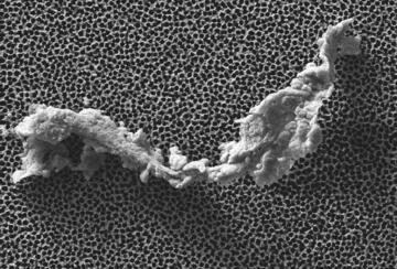 A small particle against a porous background.