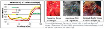 Common bile duct