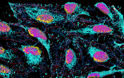 Colorized micrograph shows cells with pink centers and turquoise edges on a black background.