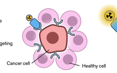 Diagram shows a radioisotope attached to a cancer-targeting molecule and how the molecule attaches to a cancer cell and injects alpha radiation. 