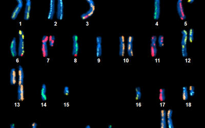 An image showing 22 pairs of numbered and color-coded chromosomes on a black background.