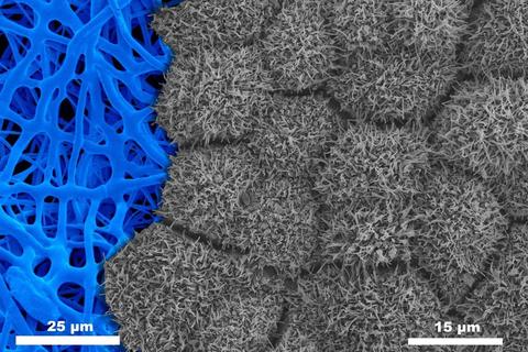 Retinal Pigment Epithelium  on nanofiber scaffold