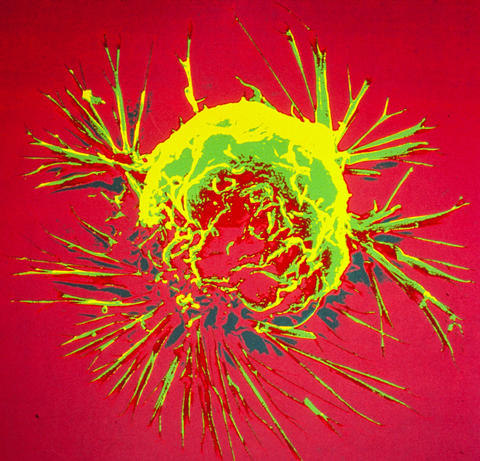 Electron micrograph of a single cell of breast cancer