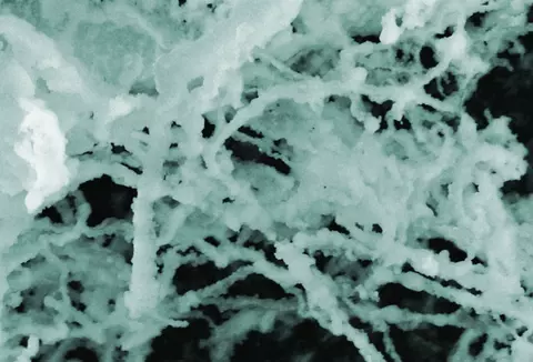 Fibrous masses from insulin