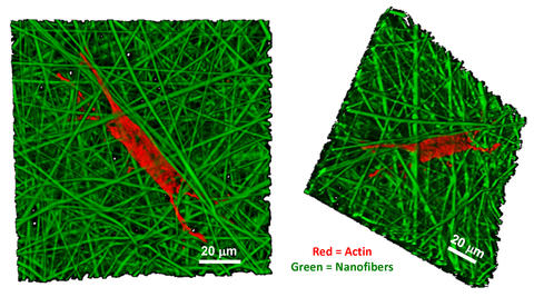 confocal microscope images detail the growth of a human bone marrow stromal cell on a nanofiber scaffold.